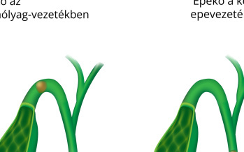 Epegörcs