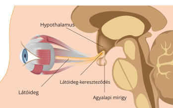 Hipofízisadenóma