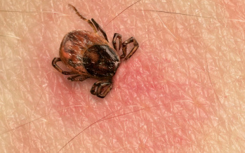 Kullancsencephalitis
