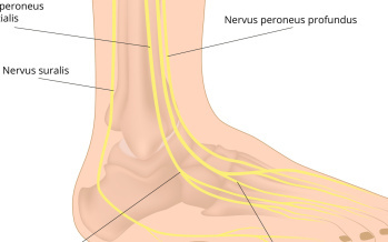 Neuropátia