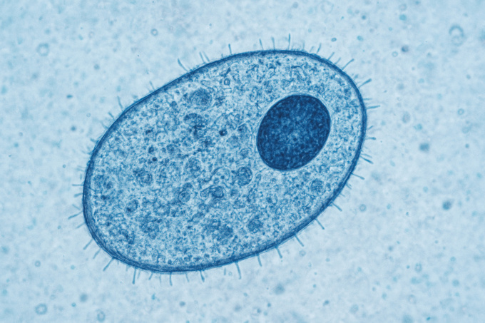 Balantidiózis – Balantidium coli