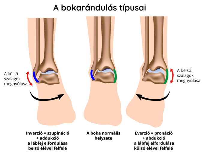 A bokarándulás típusai