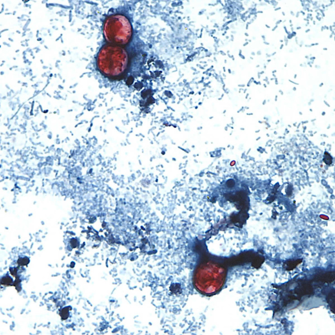 Cyclospora cayetanensis oociszták székletmintában