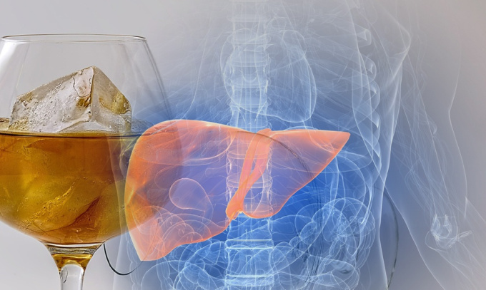 alkohol által károsított máj