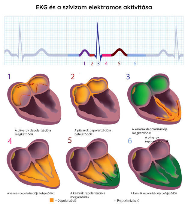EKG-felvétel – a szívizom elektromos aktivitása