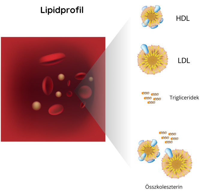 Lipidszűrés – a vér lipidszintjének ellenőrzése